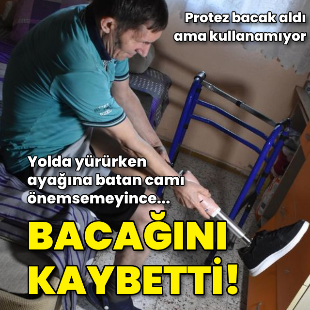 Ayağına batan camı önemsemedi, bacağını kaybetti