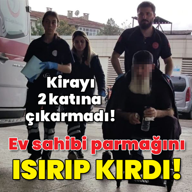 Kirayı 2 katına çıkarmadı! Ev sahibi ısırıp parmağını kırdı!