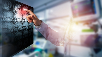 "İnmede ilk 4.5 saatte müdahale hayat kurtarır"