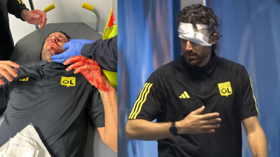 Fransa'da olay: Lyon otobüsü taşlandı