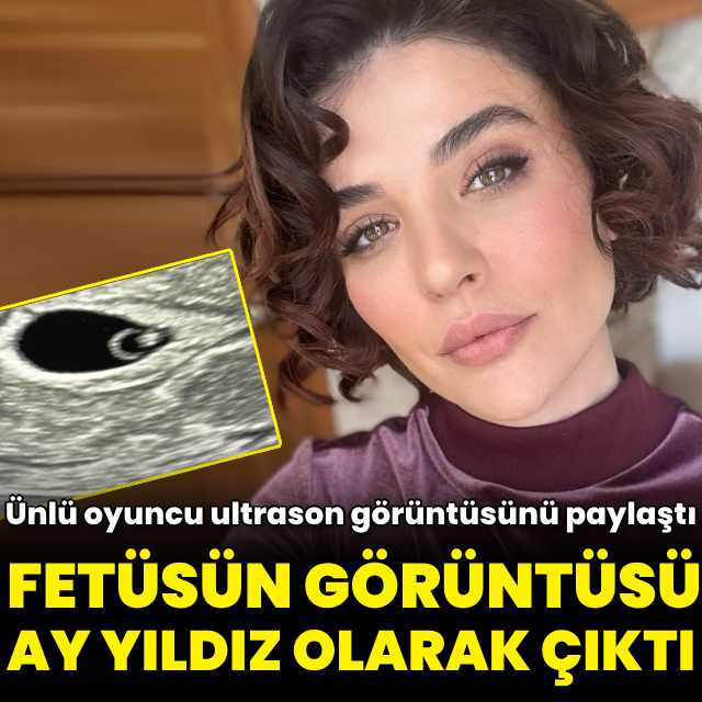 Fetüs görüntüsü ay yıldız olarak çıktı