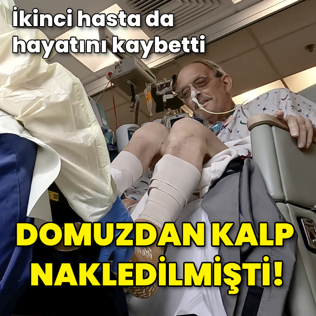 Domuzdan kalp nakli yapılan ikinci hasta da öldü