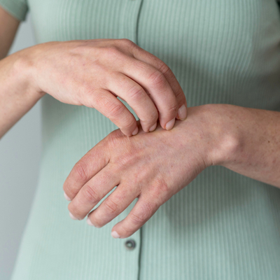 Bakan açıkladı: Uyuz salgını mı var?