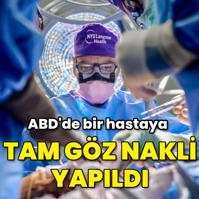 ABD´de bir hastaya `tam göz´ nakli yapıldı