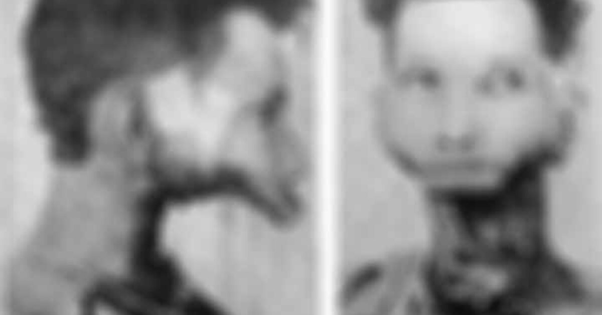 İçtiği radyumlu ilaç yüzünden çenesi parçalanan Eben Byers'ın trajik