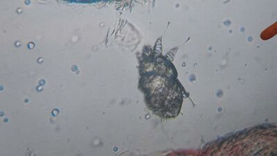 "Kliniklerdeki uyuz vakaları yüzde 25'e yükseldi"