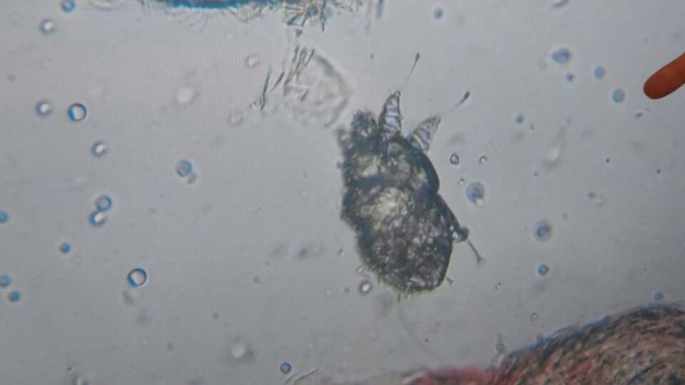 "Kliniklerdeki uyuz vakaları yüzde 25'e yükseldi"