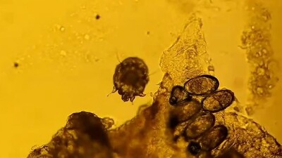 Uyuza dikkat! Sıklığı her geçen gün artıyor