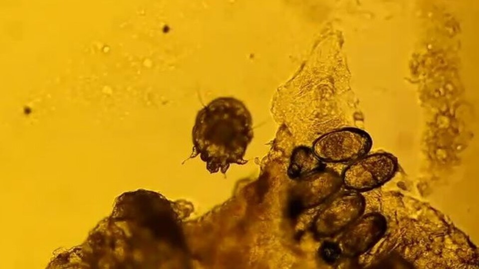 Uyuza dikkat! Sıklığı her geçen gün artıyor