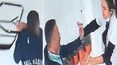 Tedaviyi beğenmedi! Kadın diş hekimini yaraladı!