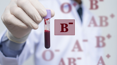 B Rh negatif kan grubu özellikleri