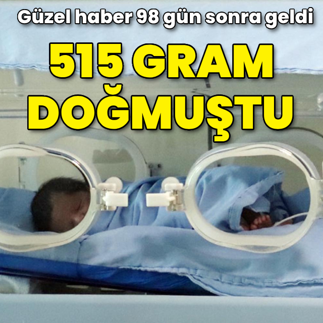 515 gram doğdu! Güzel haber 98 gün sonra geldi