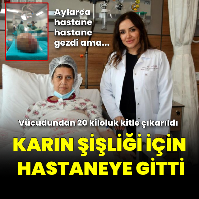 Karın şişliği için gitti, 20 kiloluk kitle çıkarıldı