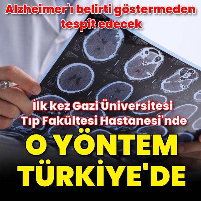 Alzheimer'ı belirti göstermediği dönemde tespit edebilen yöntem Türkiye'de