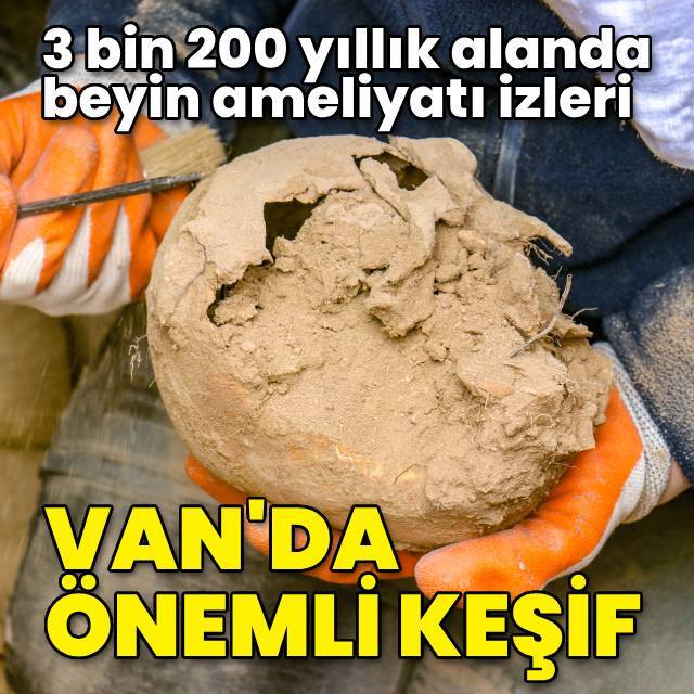 3 bin 200 yıllık alanda beyin ameliyatı izleri!