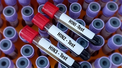 İngiltere'de H1N2 grip türü ilk kez insanda görüldü