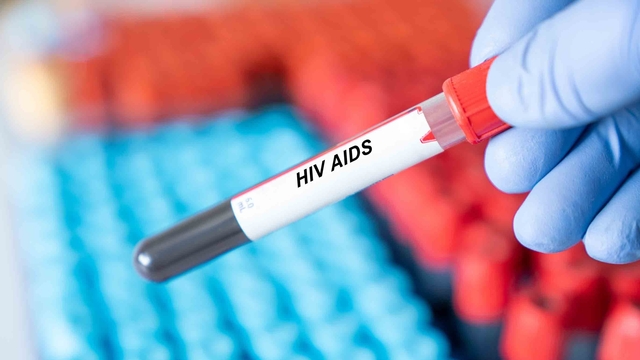 HIV dünyada azalıyor, Türkiye'de artıyor