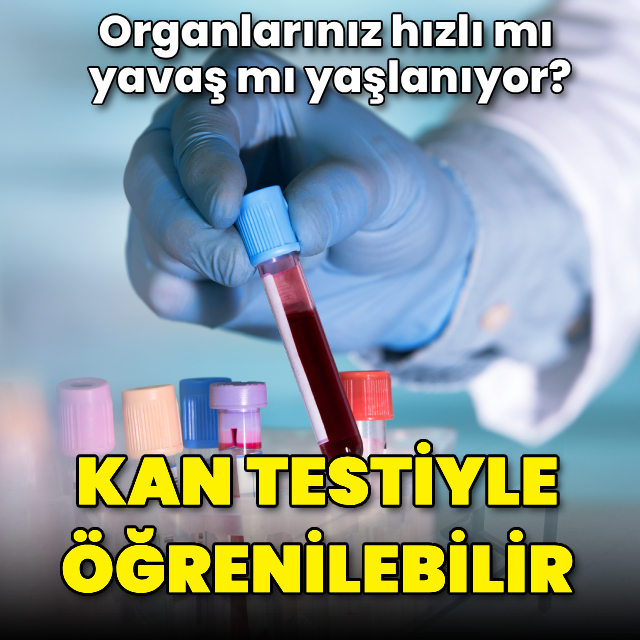 Kan testiyle öğrenilebilir! Organlarınız hızlı mı yavaş mı yaşlanıyor?