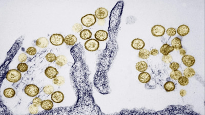 Açıklanamayan salgın hastalıklar ne kadar yaygın?