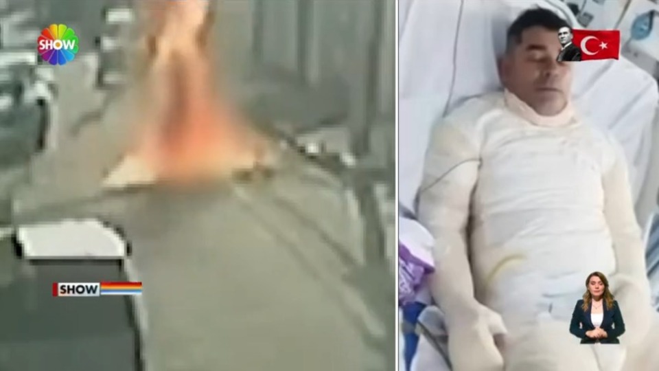 Benzin döküp kocasını yaktı