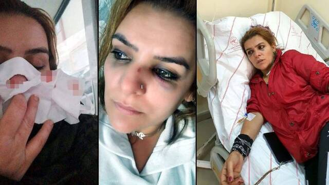Sopayla "koordinatör oldun" dayağı!