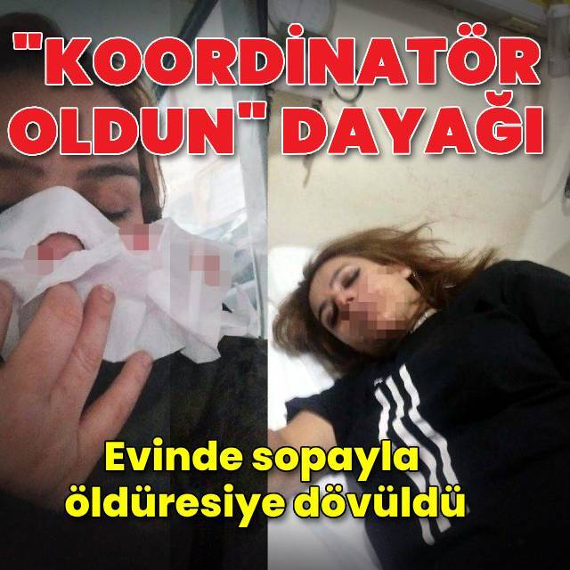 Sopayla "koordinatör oldun" dayağı!