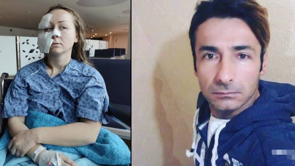 Falçatayla kesmişti! Tahliye edildi