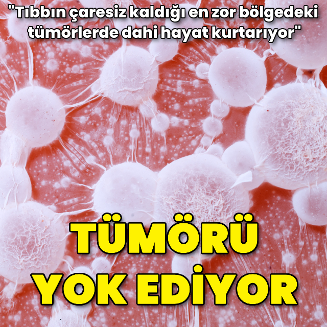 Tümörü yok eden "atom" etkisi: Proton terapi