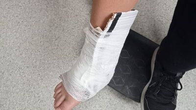 Çatlayan bileğe 'kartonlu ilk yardım'a inceleme