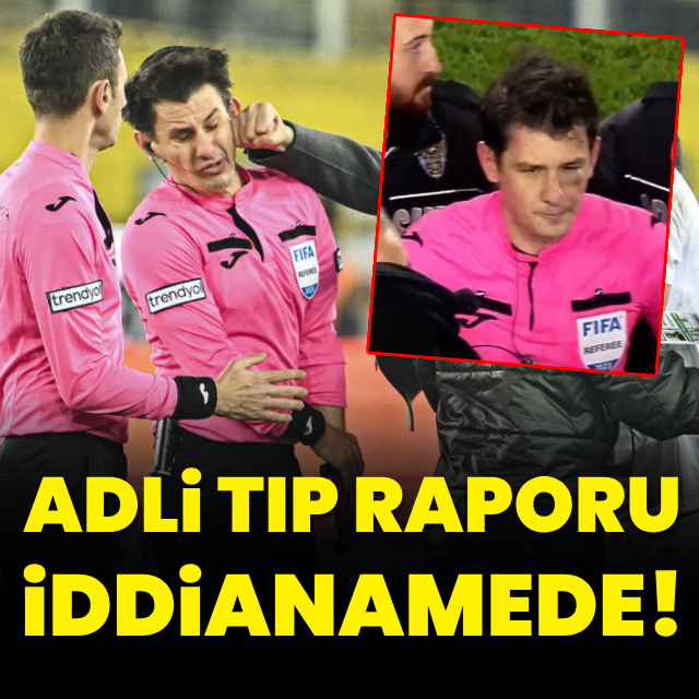 Adli Tıp Kurumu raporu iddianamede!