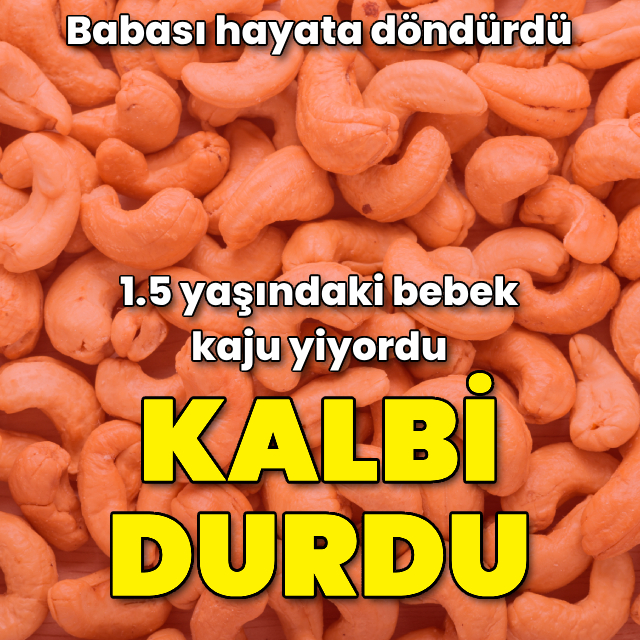 Kaju yiyordu! Kalbi duran bebeğe ilk müdahaleyi babası yaptı