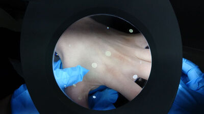 Birbirine karıştırmayın! El, ayak, ağız ve uyuz...