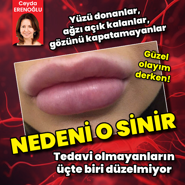 Yapılan hatalı estetik uygulamalar tedavi edilmezse 3 kişiden birinde iyileşme olmuyor