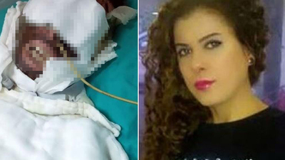 Sevgilisini kimyasal maddeyle yaralamıştı! Cezası belli oldu