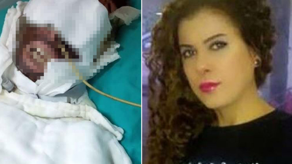 Sevgilisini kimyasal maddeyle yaralamıştı! Cezası belli oldu