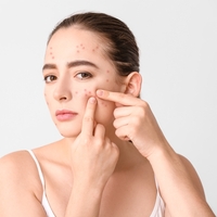 Sivilce izleri nasıl geçer?