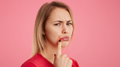 Uçuk neden olur ve tedavisi nedir?