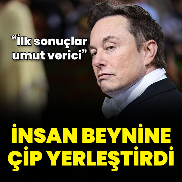 İnsan beynine çip yerleştirdi