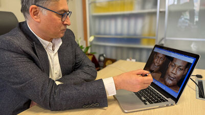 Dudaklarının şekli bozuldu, dişleri döküldü!