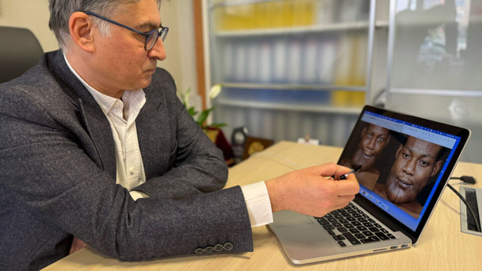 Dudaklarının şekli bozuldu, dişleri döküldü!