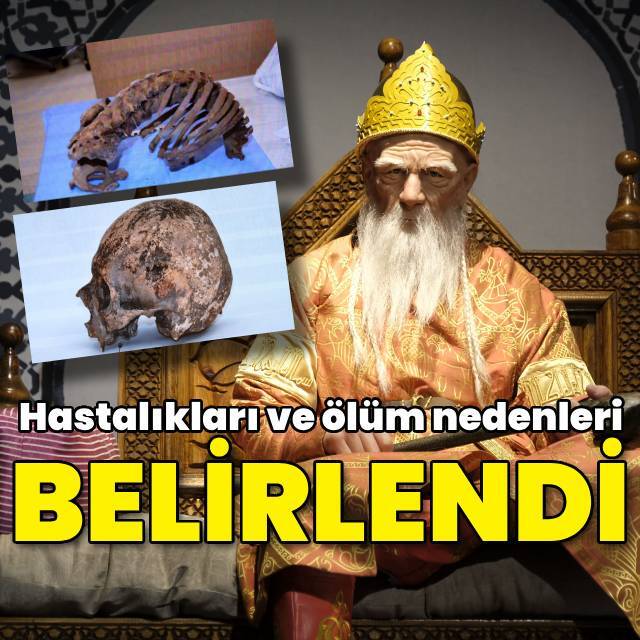 Selçuklu sultanlarının hastalıkları ve ölüm nedenleri belirlendi