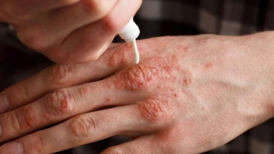 Egzama nasıl geçer