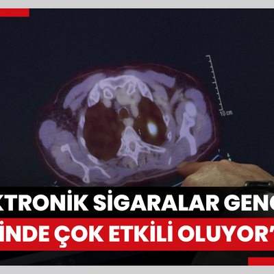 Prof. Dr. Görgüner: Elektronik sigaralar gençler üzerinde çok etkili oluyor