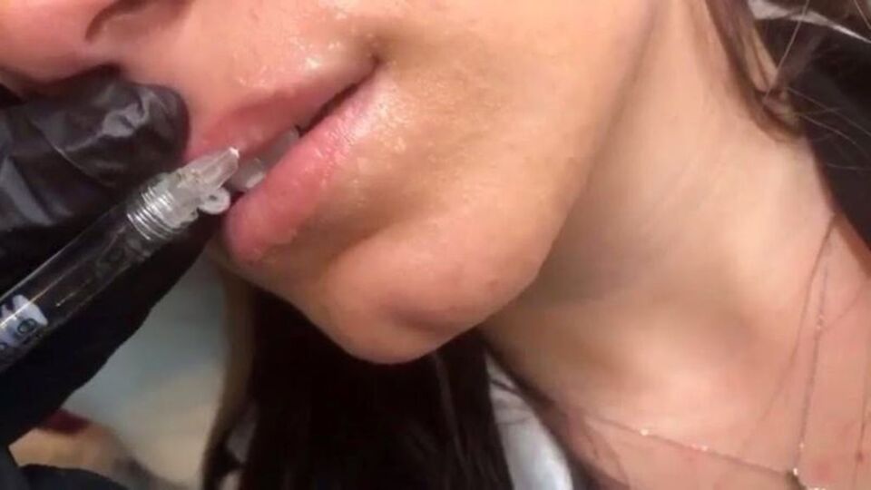 Estetik çılgınlığı uyarısı!