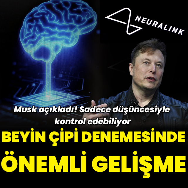 Musk'ın beyin çipi projesinde yeni gelişme