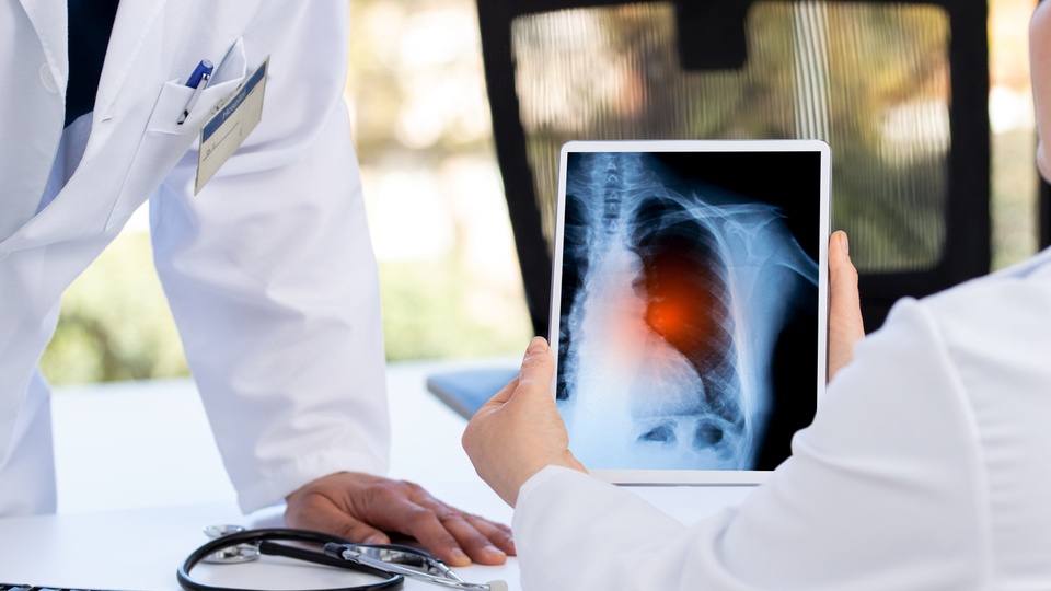 Akciğer kanseri nedir?