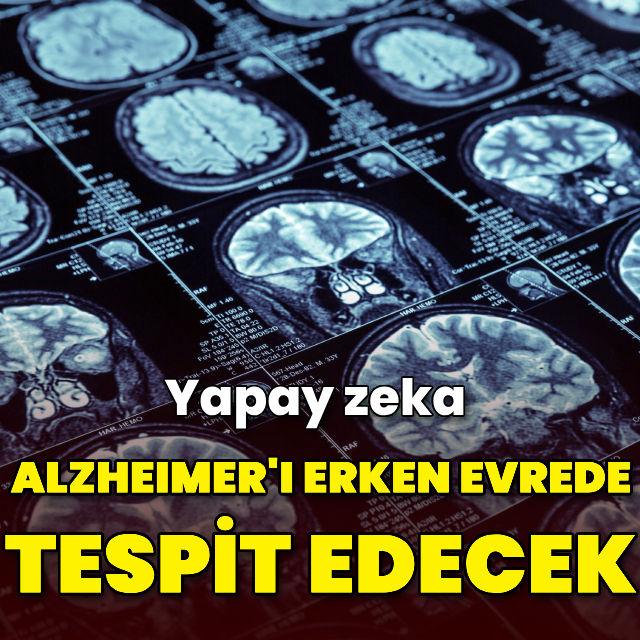 Yapay zeka Alzheimer'ı erken evrede tespit edecek