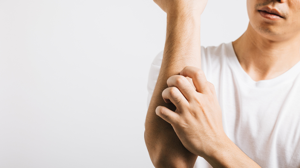 Uyuz belirtileri ve tedavi yöntemleri