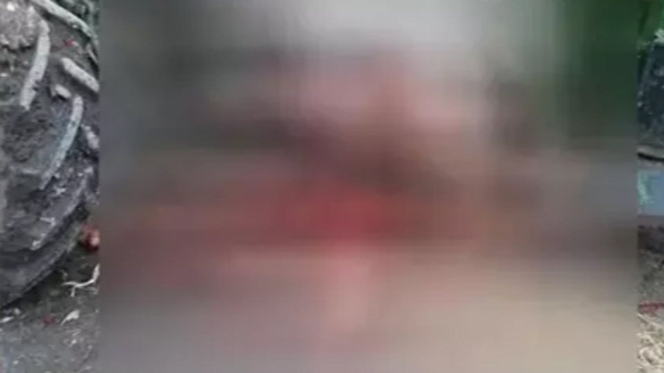 Patoz makinesine elbisesi sıkıştı! Feci olay!