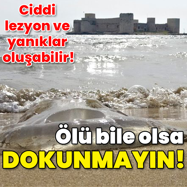Ölü bile olsa dokunmayın! Ciddi lezyon ve yanıklar oluşabilir!
